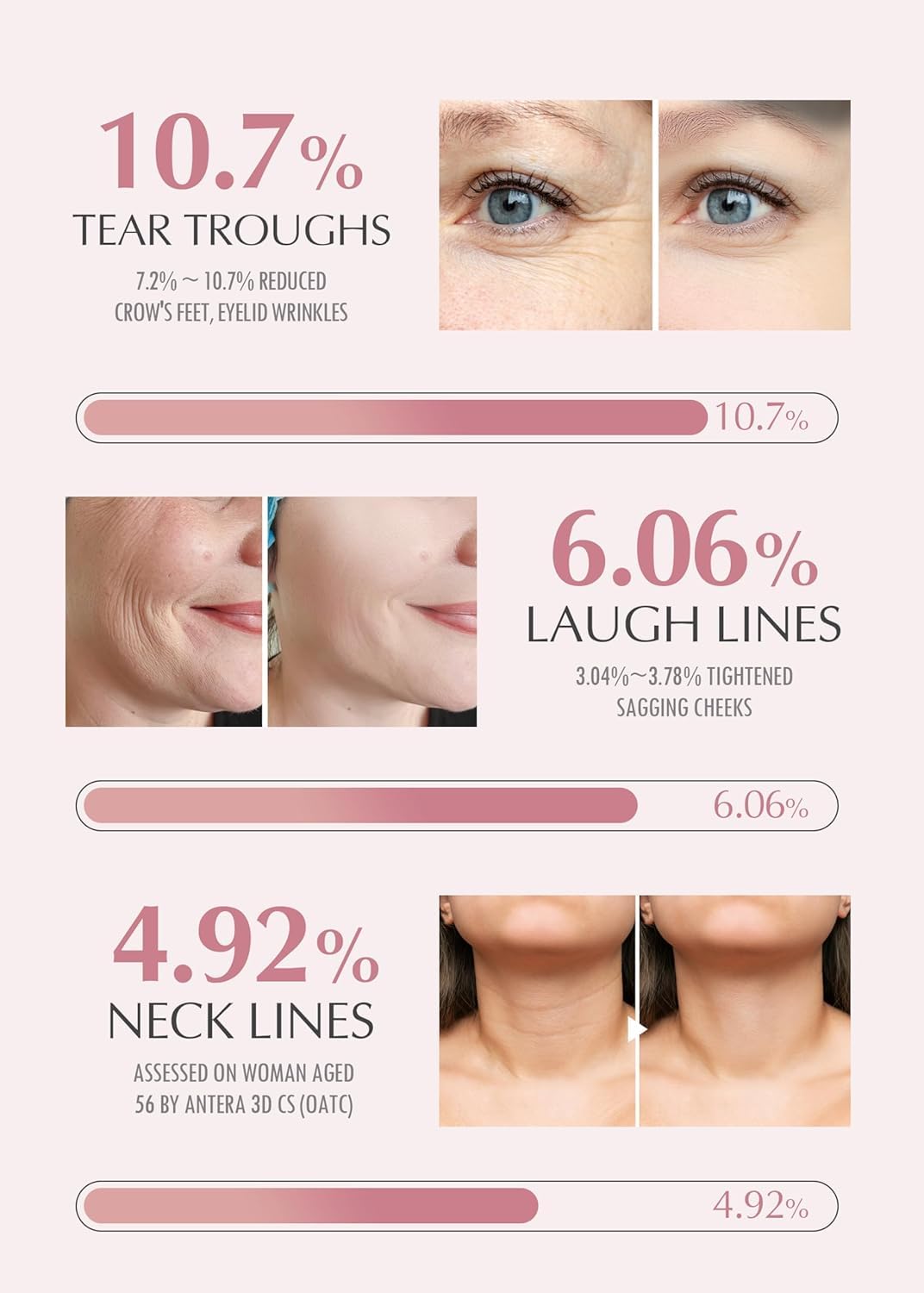 KAHI Wrinkle Bounce Multi Balm Stick – Collagen & Anti-Aging Glow Balm(0.32 ounces) Queenkong