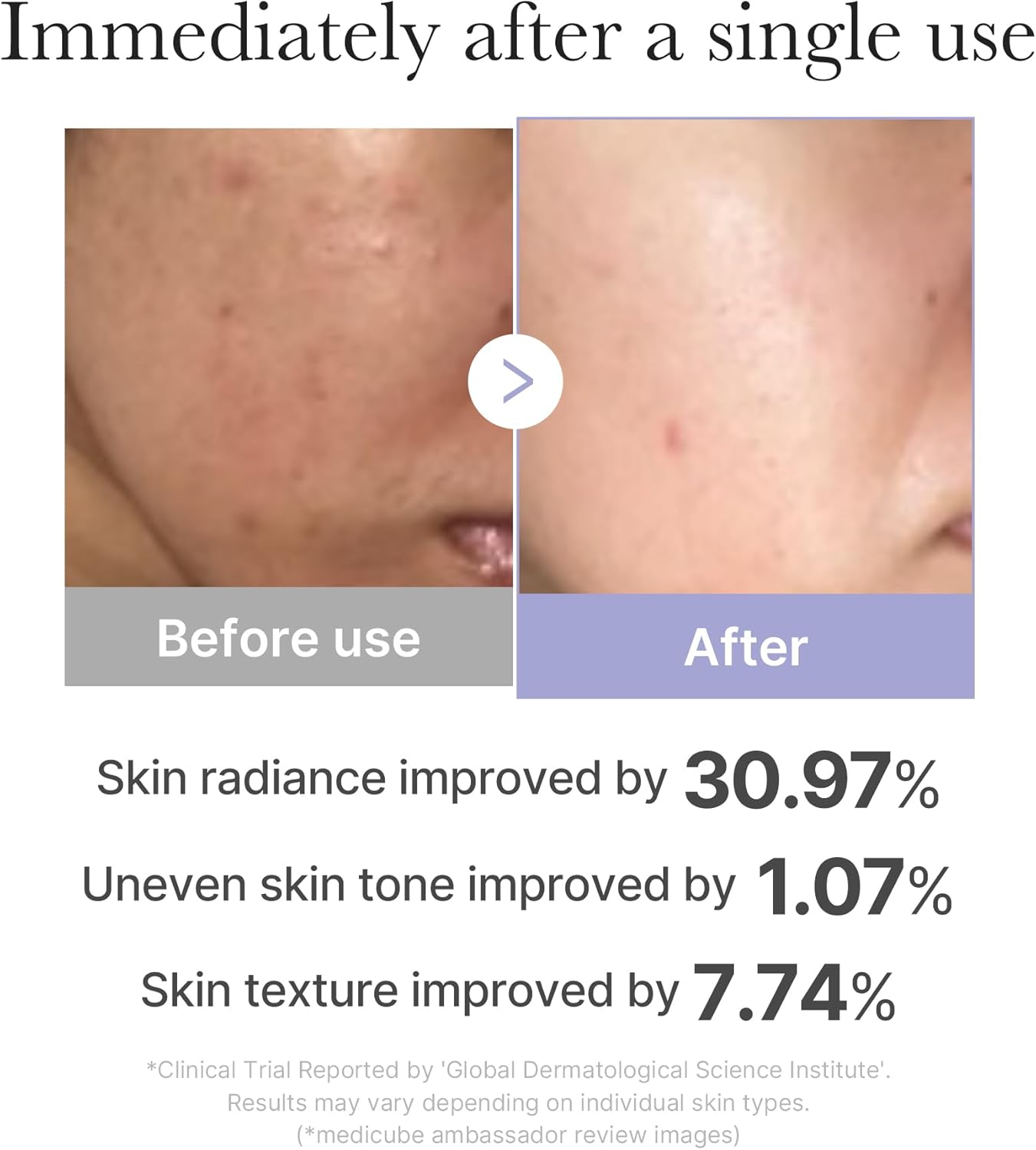 Medicube Mini Booster Pro + Collagen Jelly Cream Duo Set Queenkong