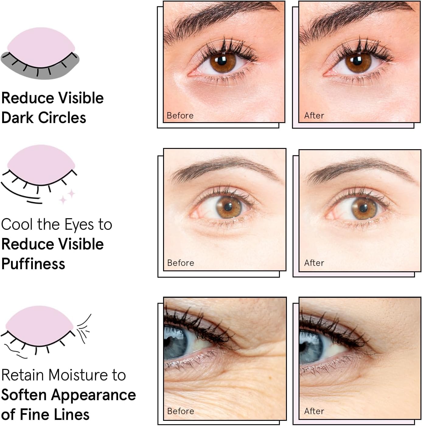 Grace & Stella Under Eye Mask – Award-Winning Gold Eye Patches for Dark Circles & Puffy Eyes (48 Pairs) Queenkong