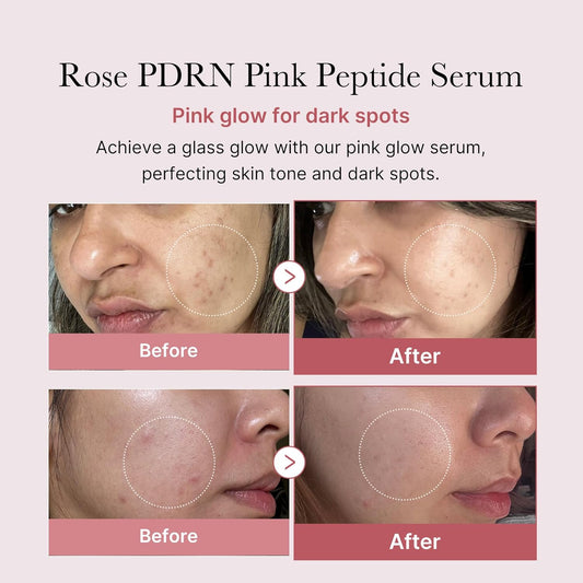 PDRN Pink Peptide Serum – Medicube Rose DNA Glow Serum for Dark Spots & Elasticity (1.01 fl.oz.) Queenkong