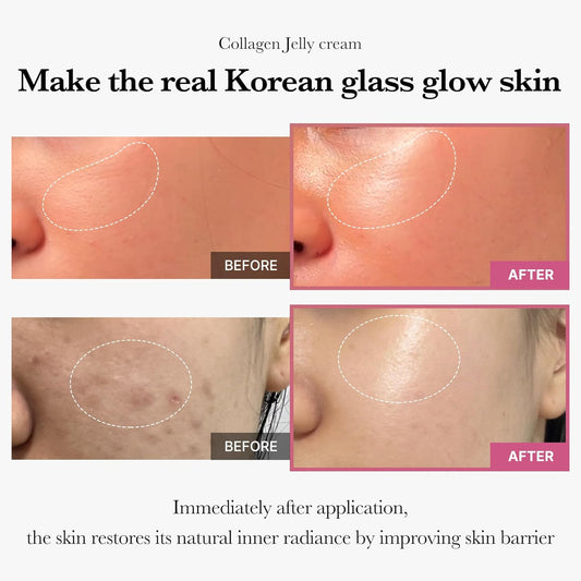 Medicube Mini Booster Pro + Collagen Jelly Cream Duo Set Queenkong