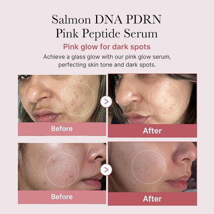 Salmon DNA PDRN Pink Peptide Serum – Medicube (30ml) Queenkong