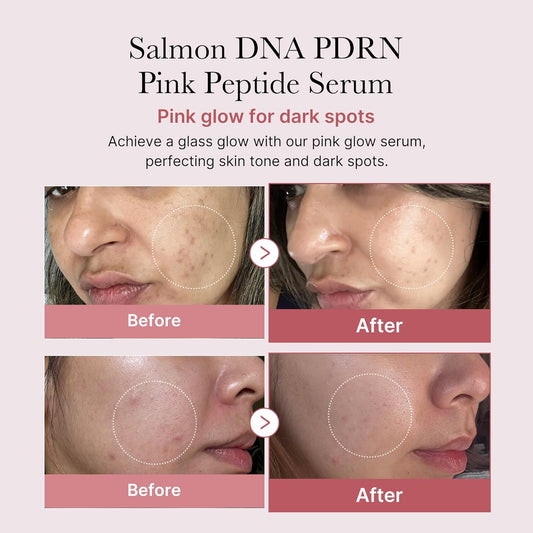 Salmon DNA PDRN Pink Peptide Serum – Medicube (30ml) Queenkong